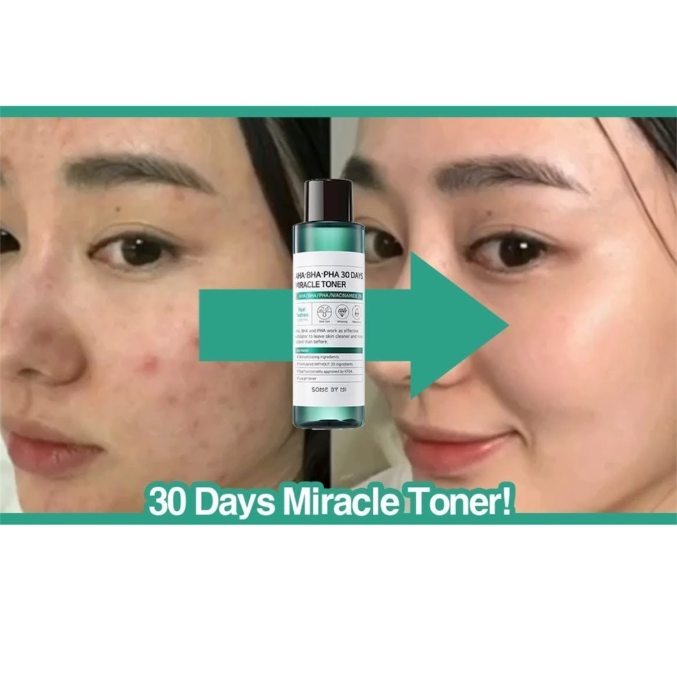 SOME BY MI AHA·BHA·PHA 30 DAYS MIRACLE TONER Очищающий тонер для лица с кислотами 30 мл